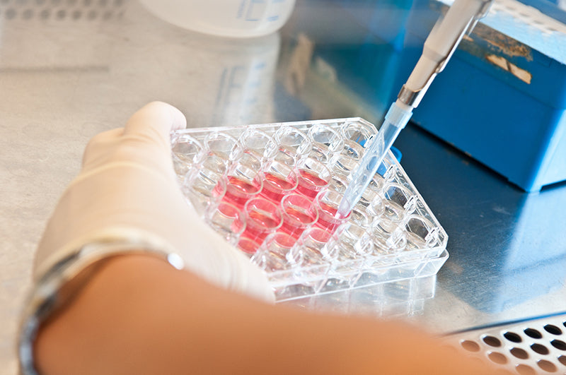 Scaling mAb production: From lab to large-scale