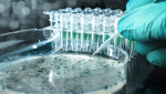 Examples of Antibody-drug conjugates
