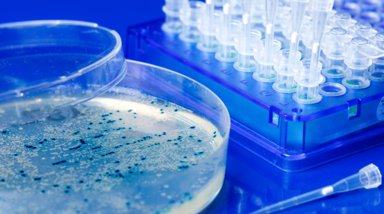 Plasmid DNA manufacturing: The process simply explained