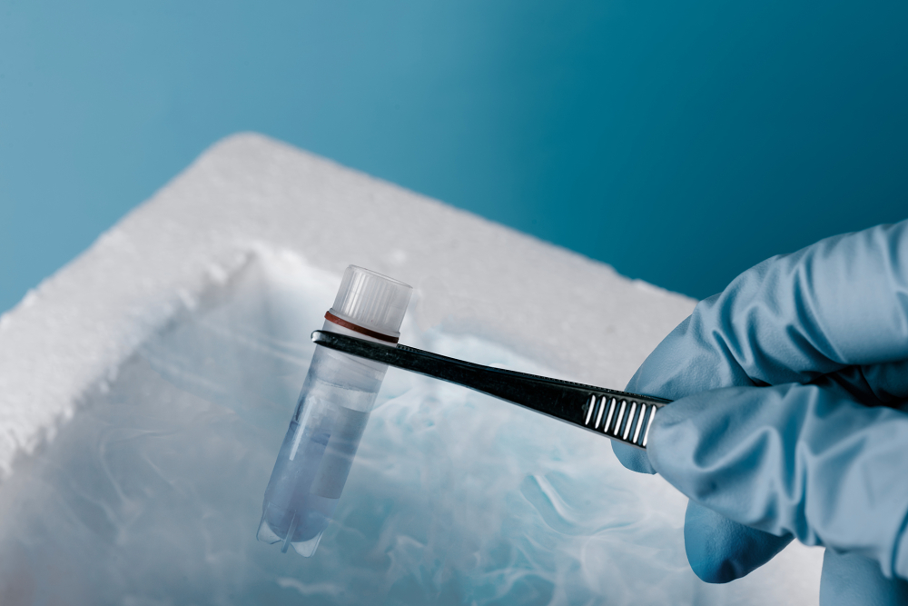 cryopreservation-cryogenic-freezing-temperature