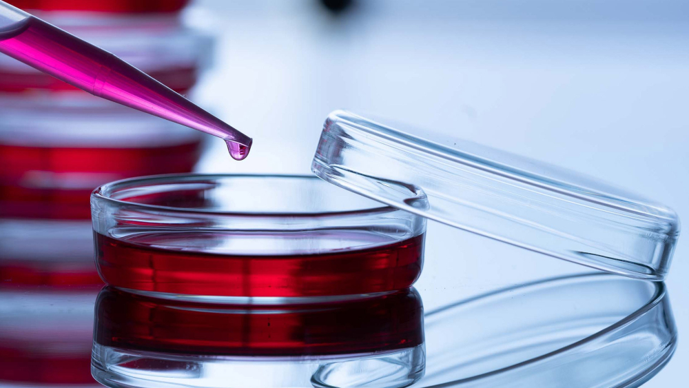 Cell line growth transfection Cell line growth transfection